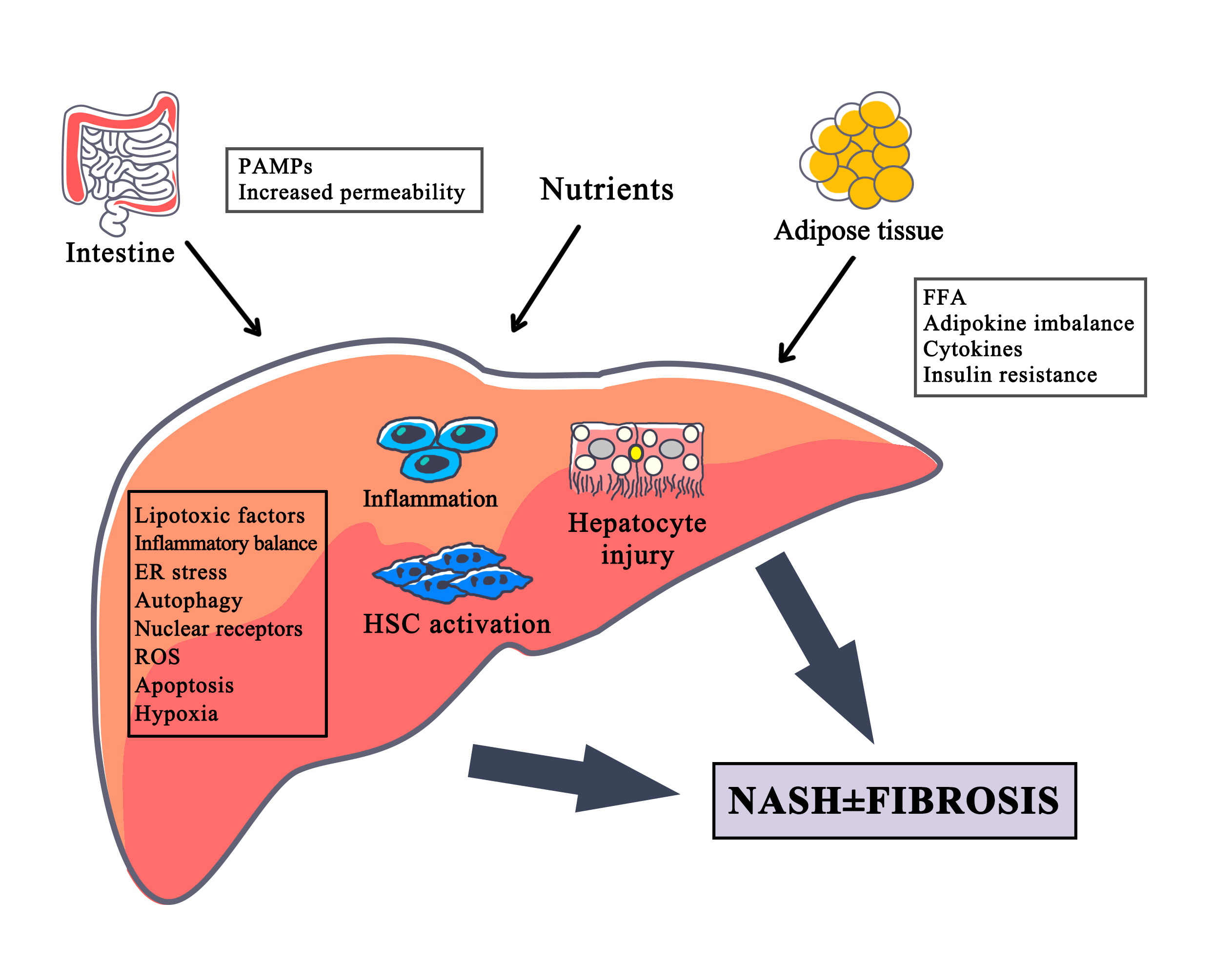 Nonalcoholic steatohepatitis(NASH)